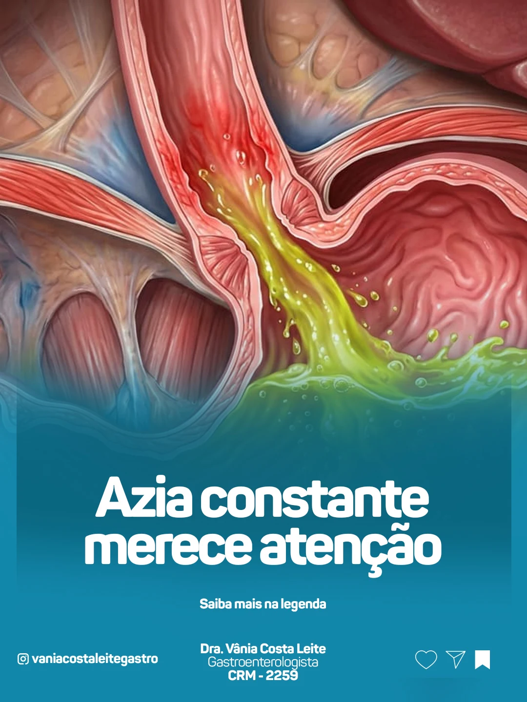 Publicação Instagram @vaniacostaleitegastro